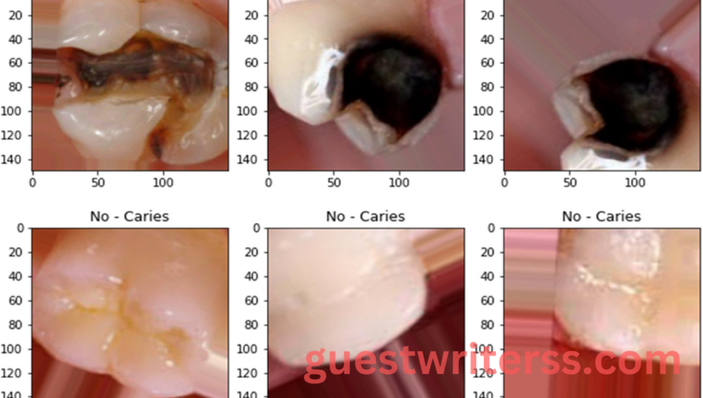  Busting Dental